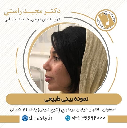 نمونه بینی طبیعی